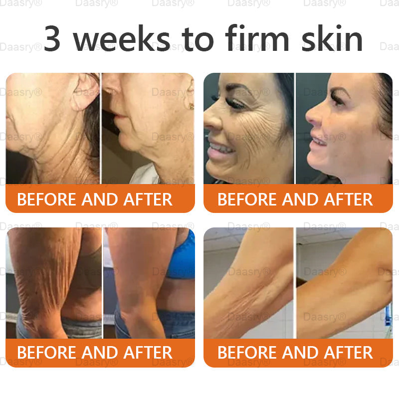 Mayo & Cleveland Clinic Store: Made IN USA - Natravor™"Dermal Gold" Botox Bee Venom Skin Restoration Cream - LAST DAY 80% OFF