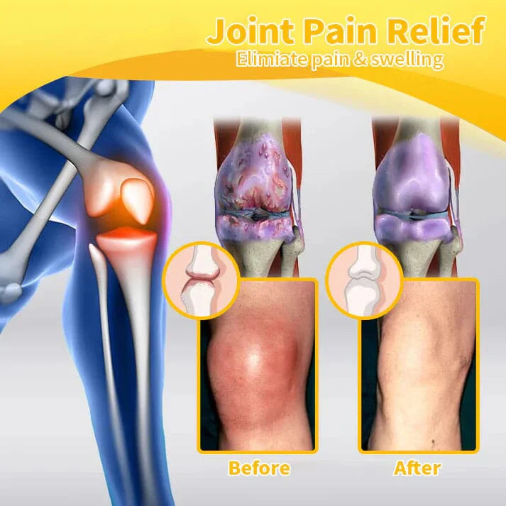 🔥Bee Venom-Infused Relief for Bones & Joints🔥