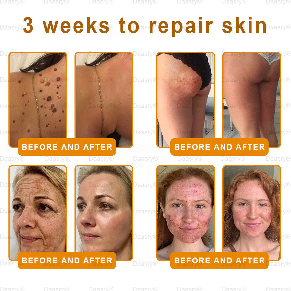 Mayo & Cleveland Clinic Store: Made IN USA - Natravor™"Dermal Gold" Botox Bee Venom Skin Restoration Cream - LAST DAY 80% OFF