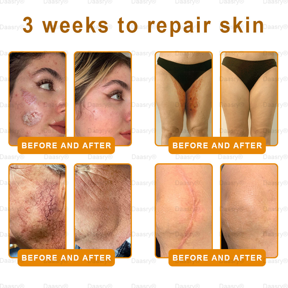 Mayo & Cleveland Clinic Store: Made IN USA - Natravor™"Dermal Gold" Botox Bee Venom Skin Restoration Cream - LAST DAY 80% OFF