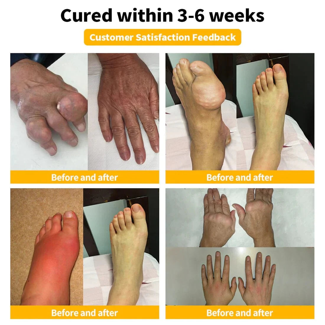 🔥Bee Venom-Infused Relief for Bones & Joints🔥
