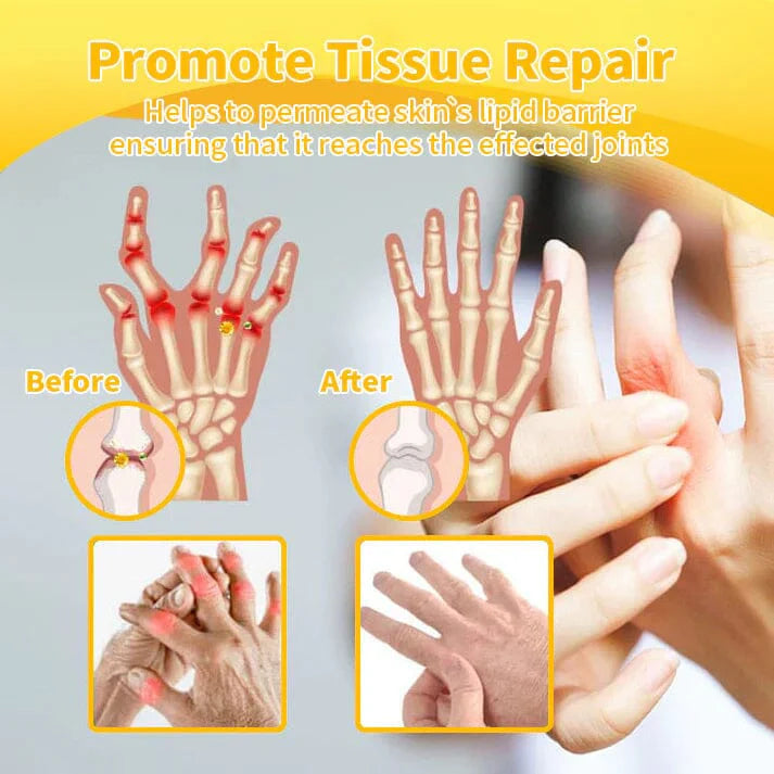 🔥Bee Venom-Infused Relief for Bones & Joints🔥