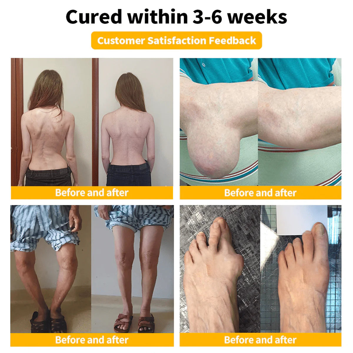 🔥Bee Venom-Infused Relief for Bones & Joints🔥