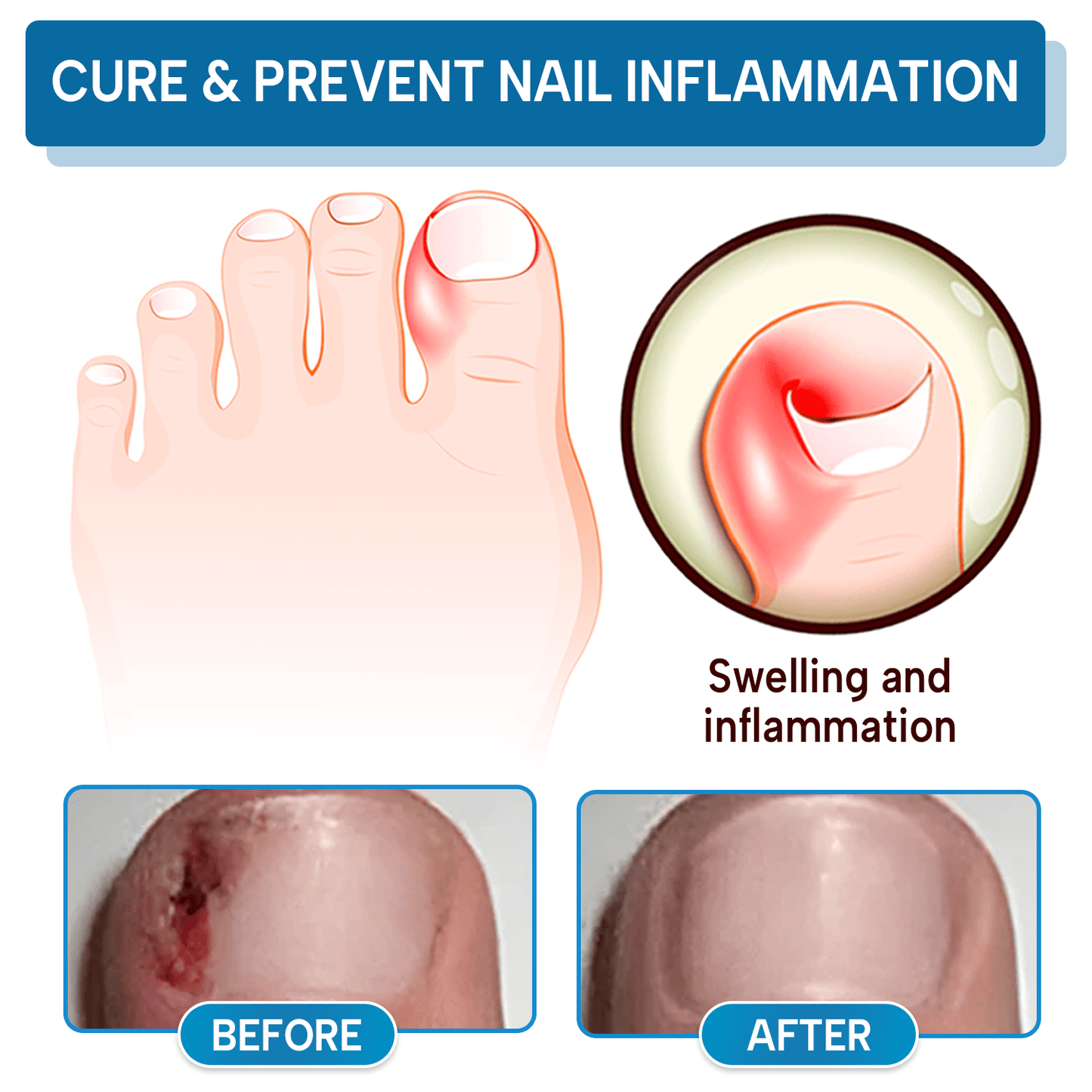 WORDKIN® OnyxiGuard Fungal Repair Herbal Spray