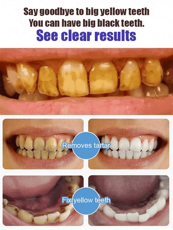 🔥2025 Hot Sale⏰Super Probiotic-6 Toothpaste with 6 Probiotics oalance Oral microbiota strength